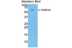 Western Blotting (WB) image for anti-Complement Factor D (CFD) (AA 1-253) antibody (ABIN3205987) (Adipsin antibody  (AA 1-253))