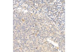 Immunohistochemistry of paraffin-embedded human tonsil using IL21 Rabbit pAb (ABIN6128086, ABIN6142359, ABIN6142360 and ABIN6223071) at dilution of 1:50 (40x lens). (IL-21 antibody  (AA 25-162))