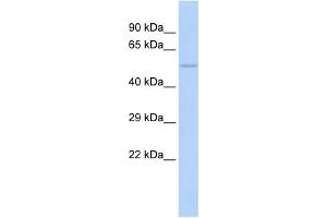 WB Suggested Anti-NFIC Antibody Titration:  1 ug/ml  Positive Control:  MCF-7 whole cell lysates