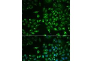 Immunofluorescence analysis of MCF7 cells using PLA2G2D Polyclonal Antibody (PLA2G2D antibody)