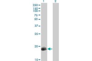 CPI-17 antibody  (AA 1-147)