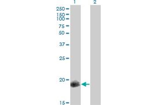 CPI-17 antibody  (AA 1-147)