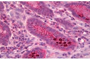 Anti-Protein Phosphatase 2 A/B Alpha antibody IHC staining of human small intestine. (PPP2R5A antibody  (N-Term))