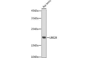 Western blot analysis of extracts of Rat testis, using UBE2B antibody (ABIN7271173) at 1:1000 dilution. (UBE2B antibody)