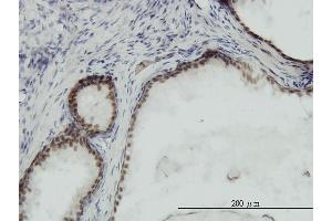 Immunoperoxidase of monoclonal antibody to RPA3 on formalin-fixed paraffin-embedded human prostate. (RPA3 antibody  (AA 12-121))