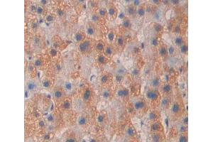 Used in DAB staining on fromalin fixed paraffin- embedded liver tissue (PTPN21 antibody  (AA 981-1174))