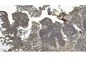 IHC analysis of ERK5/MAPK7 using anti-ERK5/MAPK7 antibody (ABIN7600701).