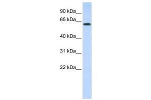 Western Blotting (WB) image for anti-Tripartite Motif Containing 55 (TRIM55) antibody (ABIN2458740) (TRIM55 antibody)