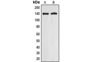 Western blot analysis of EIF5B expression in A549 (A), Jurkat (B) whole cell lysates. (EIF5B antibody  (C-Term))