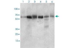 Western blot analysis of Lane 1: Hela cell lysate; Lane 2: Jurkat cell lysate; Lane 3: HEK293 cell lysate; Lane 4: A431 cell lysate; Lane 5: HepG2 cell lysate; Lane 6: RAJI cell lysate with CTNNBL1 monoclonal antibody, clone 1E4F5  at 1:500-1:2000 dilution. (CTNNBL1 antibody  (AA 390-557))