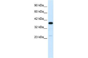WB Suggested Anti-C4BPB Antibody Titration:  0. (C4BPB antibody  (N-Term))