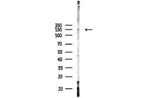 Western blot analysis of lysates from COLO205 cells(UV 30 min treatment), using MMRN1 Antibody at 1/1000 dilution.