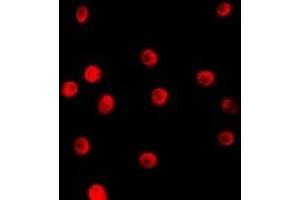 Immunofluorescent analysis of TCEAL1 staining in HepG2 cells. (TCEAL1 antibody)
