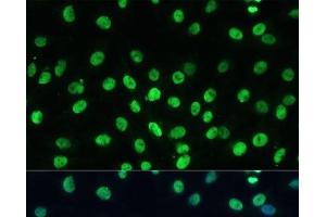 Immunofluorescence analysis of C6 cells using TRIM28 Polyclonal Antibody at dilution of 1:100 (40x lens). (KAP1 antibody)