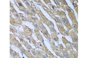 Immunohistochemistry of paraffin-embedded Human liver using CAD Polyclonal Antibody at dilution of 1:100 (40x lens). (CAD antibody)