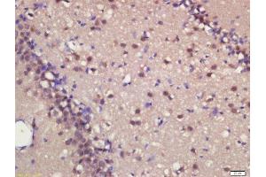 Formalin-fixed and paraffin embedded rat brain labeled with Rabbit Anti-MASH1 Polyclonal Antibody, Unconjugated  at 1:200 followed by conjugation to the secondary antibody and DAB staining (ASCL1 antibody  (AA 151-236))