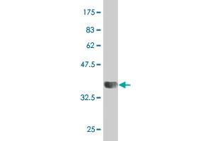 Western Blot detection against Immunogen (36. (HSPB8 antibody  (AA 97-196))