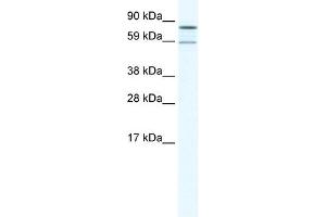 Western Blot showing PARN antibody used at a concentration of 1-2 ug/ml to detect its target protein. (PARN antibody  (N-Term))