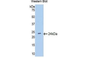 Western blot analysis of the recombinant protein. (IFNA5 antibody  (AA 22-189))