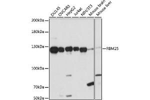Western blot analysis of extracts of various cell lines, using RBM25 antibody (ABIN7270082) at 1:1000 dilution.