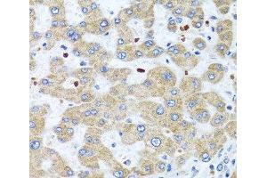 Immunohistochemistry of paraffin-embedded Human liver using NMU Polyclonal Antibody at dilution of 1:100 (40x lens). (Neuromedin U antibody)