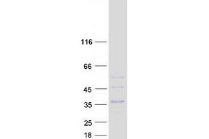 CLEC4E Protein (Myc-DYKDDDDK Tag)