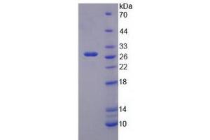 Image no. 1 for Potassium Inwardly-Rectifying Channel, Subfamily J, Member 10 (KCNJ10) (AA 165-379) protein (His tag) (ABIN4991057)