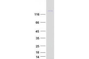 Validation with Western Blot (ROCK2 Protein (Myc-DYKDDDDK Tag))