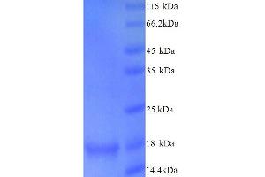 Synuclein, alpha (Non A4 Component of Amyloid Precursor) (SNCA) (AA 1-140), (full length) protein (His tag) (SNCA Protein (AA 1-140, full length) (His tag))