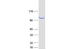 Validation with Western Blot (SCEL Protein (Transcript Variant 1) (Myc-DYKDDDDK Tag))