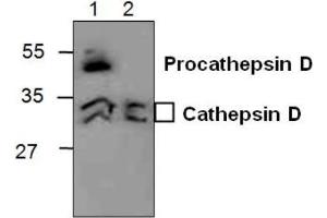 Western blot analysis of Cathepsin D in 3T3 cell lysate (Lane 1) and in Rat kidney tissue lysate (Lane 2). (Cathepsin D antibody)