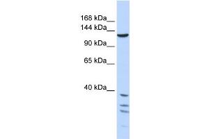 WB Suggested Anti-TNKS Antibody Titration:  1 ug/ml  Positive Control:  721_B cell lysate TNKS is strongly supported by BioGPS gene expression data to be expressed in Human 721_B cells (TNKS antibody  (Middle Region))