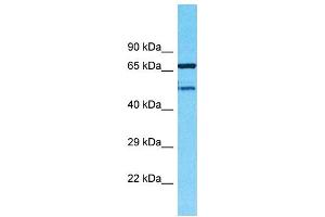 Western Blotting (WB) image for anti-Transmembrane Protein 232 (TMEM232) (N-Term) antibody (ABIN2500417) (TMEM232 antibody  (N-Term))