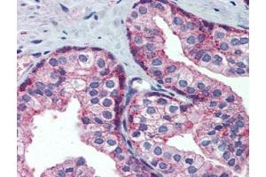 Human Prostate: Formalin-Fixed, Paraffin-Embedded (FFPE) (MARCH8 antibody  (C-Term))
