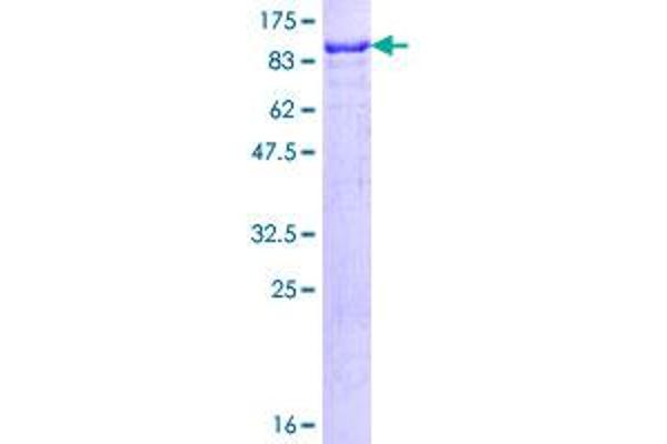 SP100 Protein (AA 1-480) (GST tag)