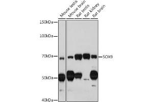 Immunohistochemistry of paraffin-embedded human thyroid cancer using SOX9 Rabbit pAb (ABIN1682861, ABIN5664083, ABIN5664085 and ABIN6219552) at dilution of 1:100 (40x lens). (SOX9 antibody  (AA 100-200))