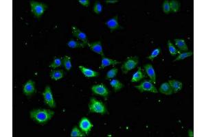 Immunofluorescent analysis of PC-3 cells using ABIN7153185 at dilution of 1:100 and Alexa Fluor 488-congugated AffiniPure Goat Anti-Rabbit IgG(H+L) (FZD4 antibody  (AA 37-222))