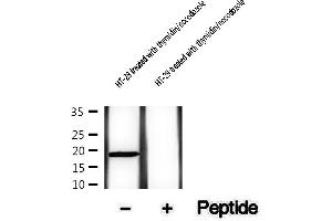 Western blot analysis of extracts of HT-29 cells treated with thymidin/nocodozole, using Phospho-Survivin (Thr34) Antibody .