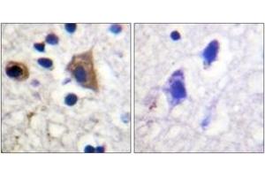 Immunohistochemistry analysis of paraffin-embedded human brain tissue, using PIP5K (Ab-307) Antibody.