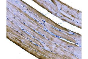 IHC analysis of PKM2 using anti-PKM2 antibody (ABIN3043381).