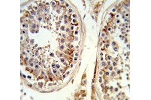 IHC analysis of FFPE human testis tissue stained with the Integrin beta 3 antibody (Integrin beta 3 antibody  (AA 734-760))