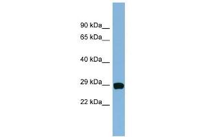 CHCHD3 antibody used at 1 ug/ml to detect target protein. (CHCHD3 antibody  (N-Term))
