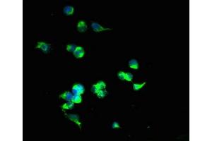 Immunofluorescent analysis of 293T cells using ABIN7170195 at dilution of 1:100 and Alexa Fluor 488-congugated AffiniPure Goat Anti-Rabbit IgG(H+L) (SLC25A4 antibody  (AA 40-102))