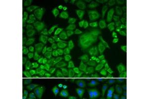 Immunofluorescence analysis of HeLa cells using ACTR3 Polyclonal Antibody (ACTR3 antibody)