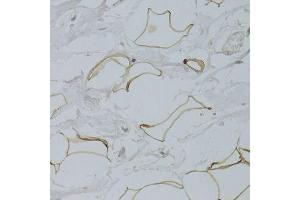 Immunohistochemistry (Paraffin-embedded Sections) (IHC (p)) image for anti-Glycerol-3-Phosphate Dehydrogenase 1 (Soluble) (GPD1) (AA 1-349) antibody (ABIN6141315)