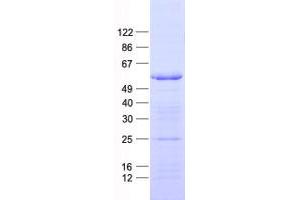 Validation with Western Blot (C1RL Protein (His tag))