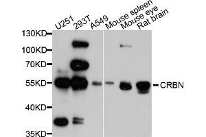 Western blot analysis of extracts of various cell lines, using CRBN antibody. (CRBN antibody)