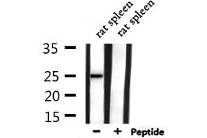 Western blot analysis of extracts from rat spleen, using CACNG1 Antibody. (CACNG1 antibody  (Internal Region))