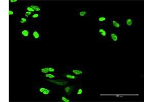 Immunofluorescence of purified MaxPab antibody to XRCC6 on HeLa cell. (XRCC6 antibody  (AA 1-609))