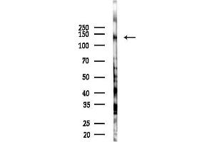 Western blot analysis of lysates from COLO205 cells(starvation 24h treatment), using IRS4 Antibody at 1/1000 dilution.